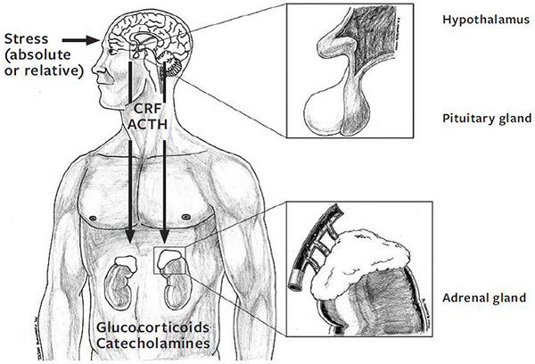 Schematic of stress responses
